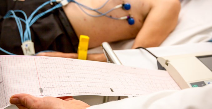 A person undergoing an ECG exam