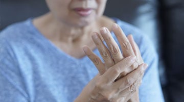 image_arthritis