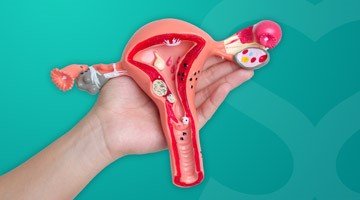 image_atewhatarefibroids