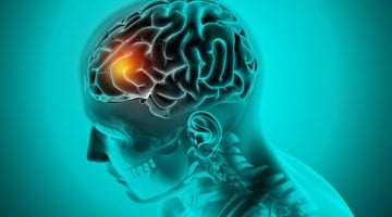 image_braintumourtreatment