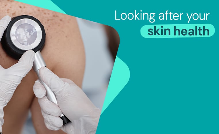 ABCDEs of melanoma