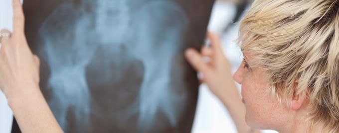 Somebody studying a pelvic xray